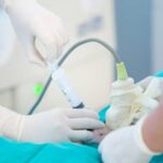 Sinh thiết gai nhau được thực hiện ở tuần thứ 10 đến tuần thứ 12 của thai kỳ